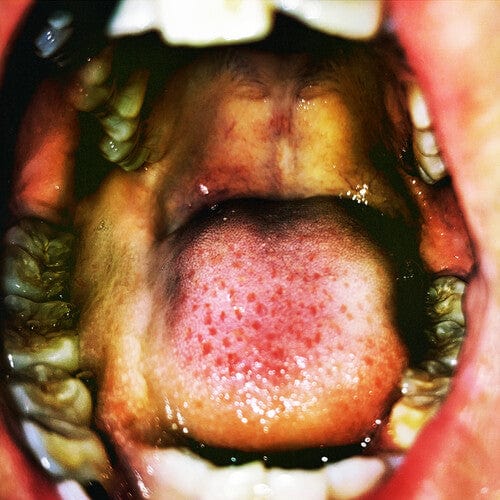 Hana Vu - Public Storage - White Vinyl